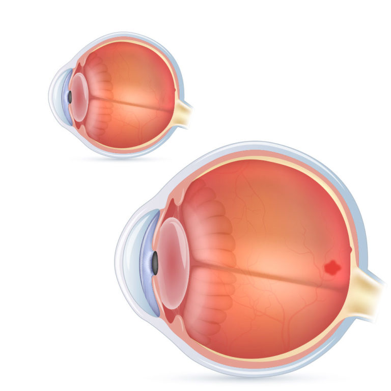 Dr Pritpal Singh Ophthalmologist Macular Degeneration